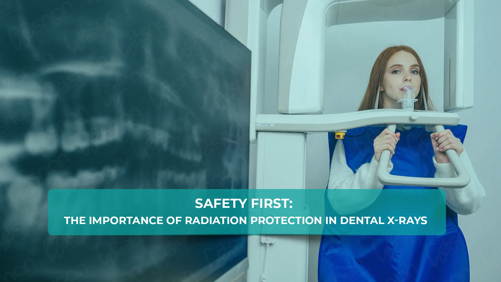Safety First The Importance of Radiation Protection in Dental XRays