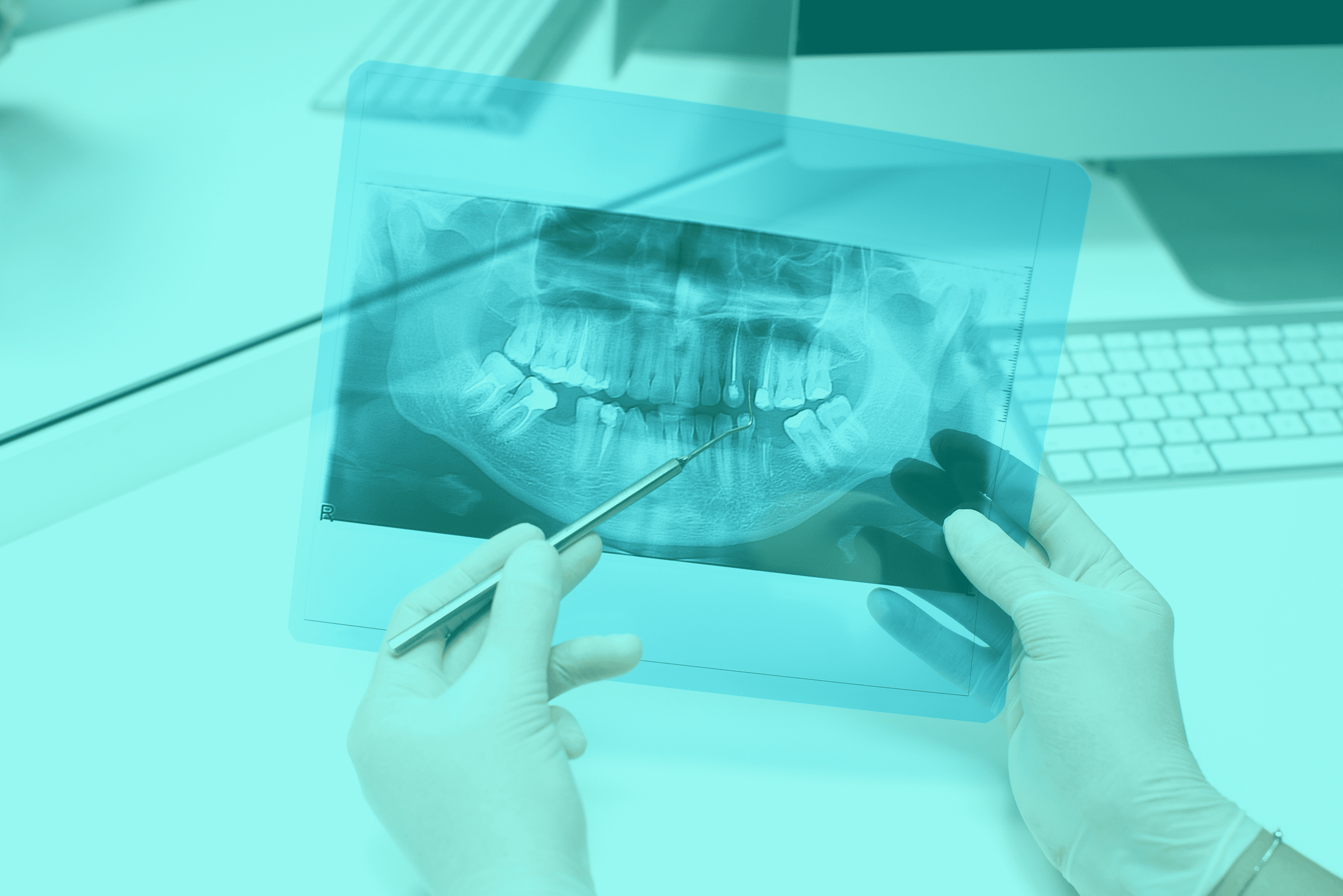 3D Volumetric Dental Tomography