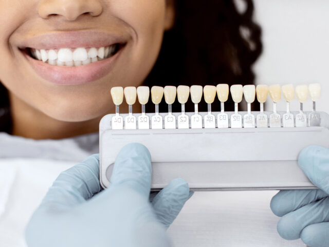 Comparing Zirconia vs. Ceramic Dental Crowns in Turkey : Which is Right for You?