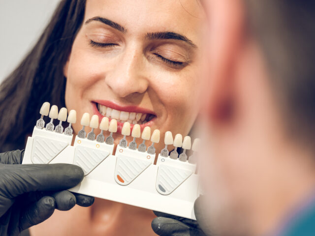 Hollywood Smile in Istanbul 