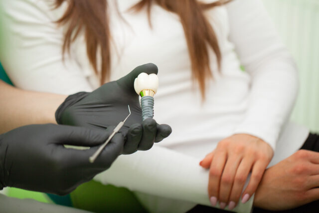 Diş kökünü taklit eden, biyouyumlu titanyum materyalinden yapılmış bir dental implant ve cerrahi aletler. 