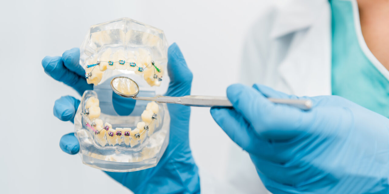 Orthodontic Treatment in Istanbul: Aligners vs. Braces – Finding Your Perfect Smile