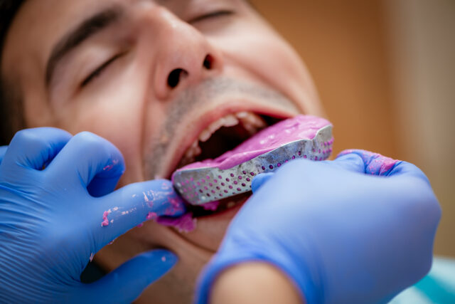 Before and after results of orthodontic treatment in Istanbul showing a straight smile.