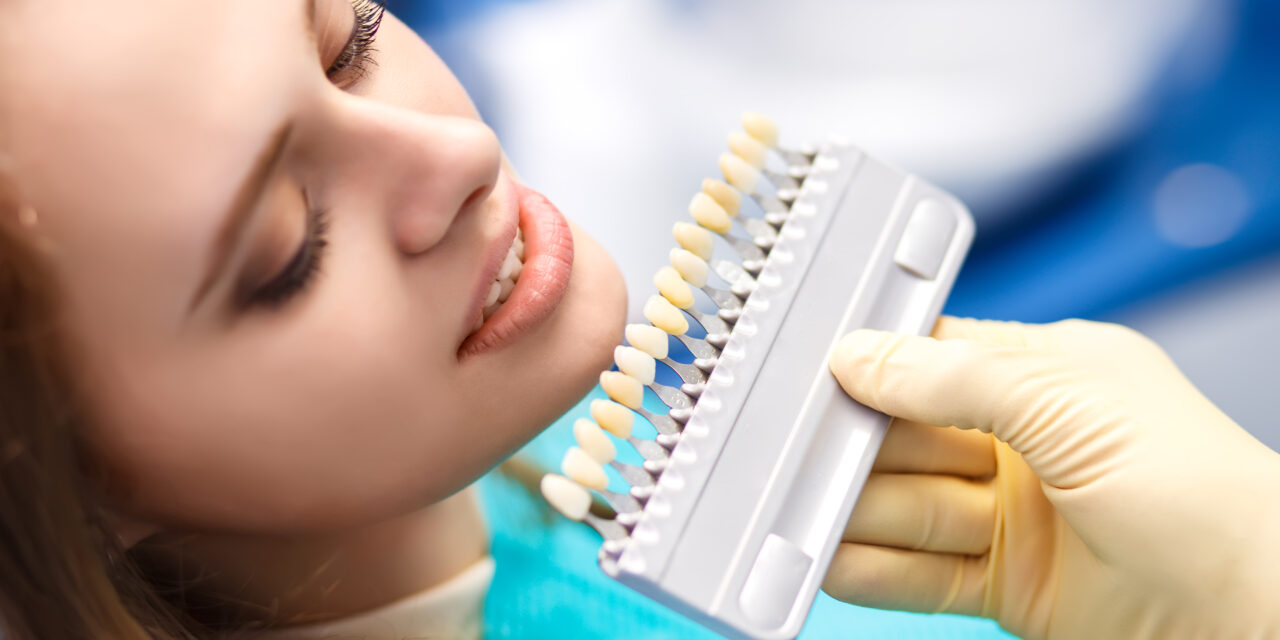 Teeth Whitening in Istanbul: Secrets for a Dazzling Smile
