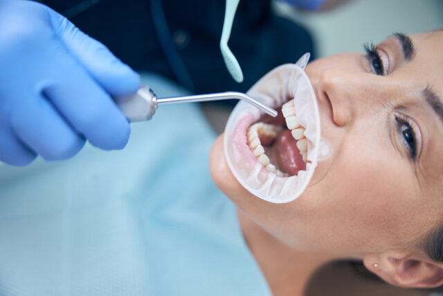 Dentist's hands in gloves holding an instrument next to a tooth model, representing a professional wisdom tooth extraction procedure. 