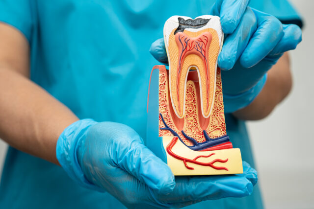 Close-up of a person applying an ice pack for wisdom tooth pain relief and swelling reduction. E-Tablolar'a aktar 
