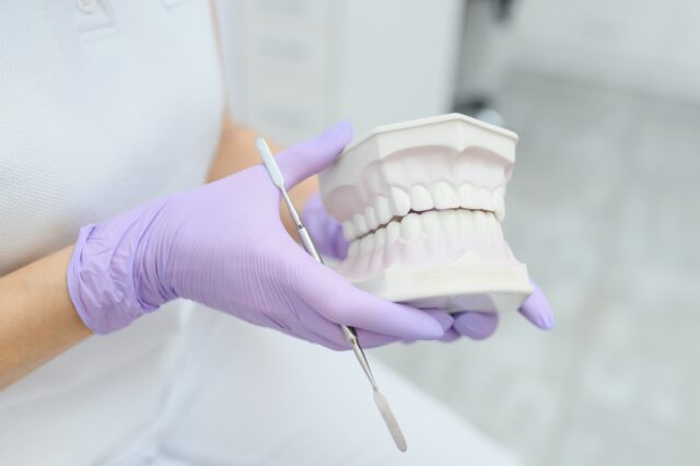 X-ray graphic showing an impacted wisdom tooth growing sideways and causing pressure and pain. 