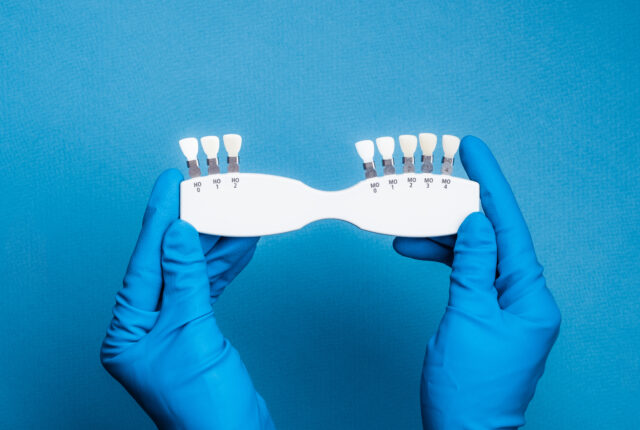 Best Dentist in Istanbul