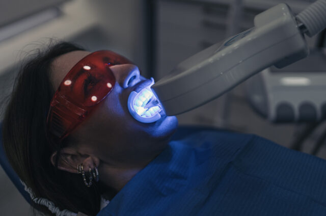 Chemical Teeth Whitening in Istanbul
