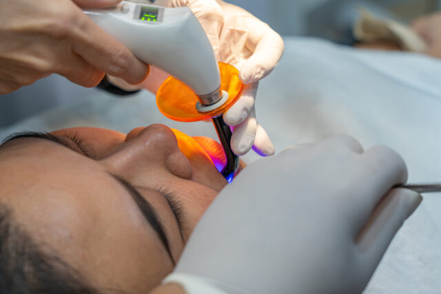 Laser dentistry teeth whitening in Istanbul