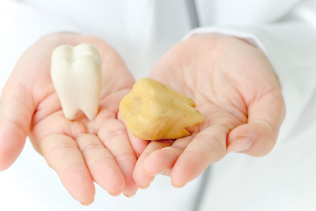 Yarım çıkan 20’lik diş çekilir mi