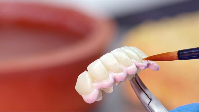 Zirconia vs Monolithic Zirconia