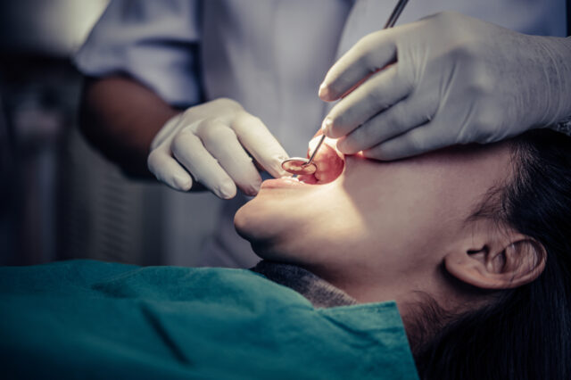 Gum Disease in Istanbul