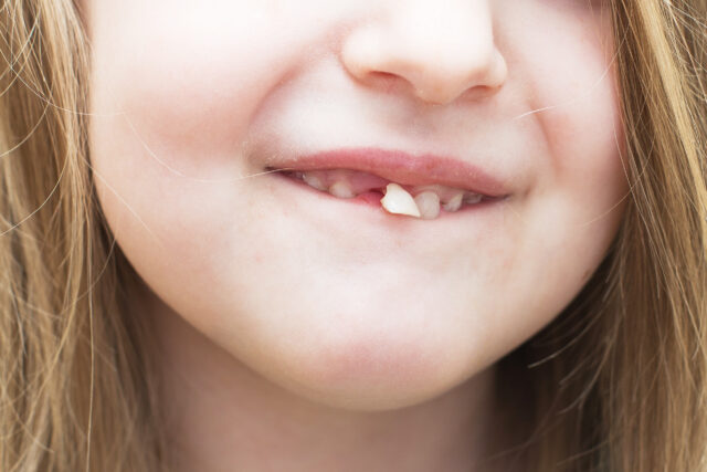 how to fix a loose tooth