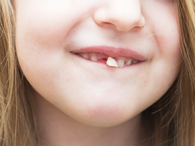 How to Fix a Loose Tooth: Causes, Treatments, and When to See a Dentist