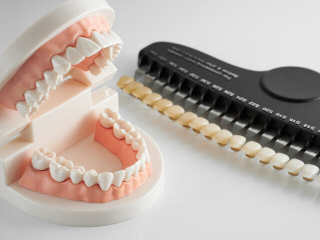 A Comprehensive Guide to Post-Veneer Dental Care