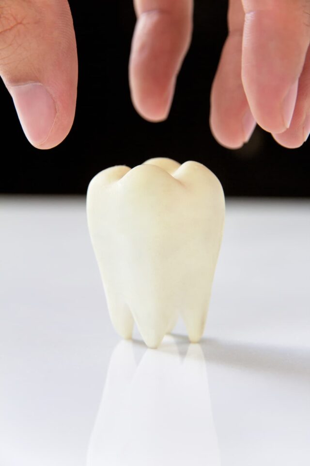 dental implant molar tooth