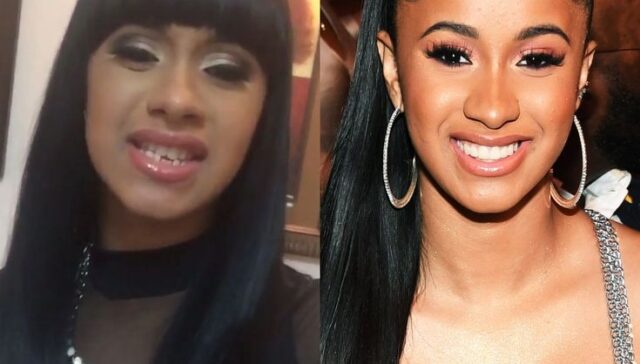 cardi b teeth