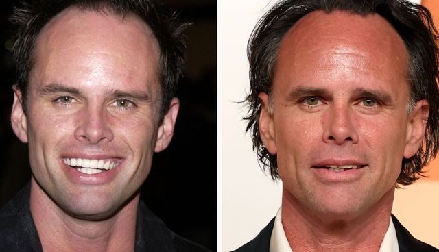 The Ultimate Guide to Walton Goggins Teeth: Trauma, Transformation, and Triumph