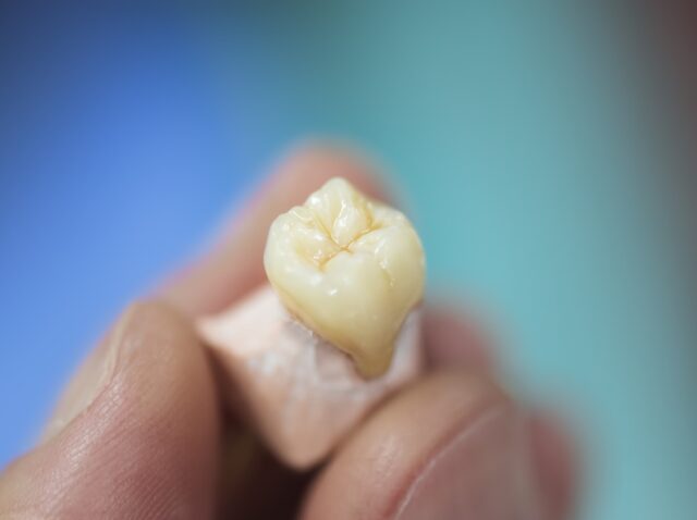 zirconia dental crown