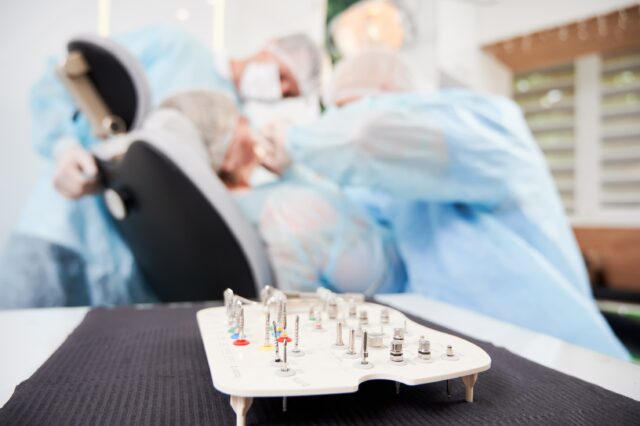 all on four dental implants