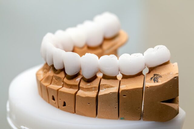 zirconia dental crown