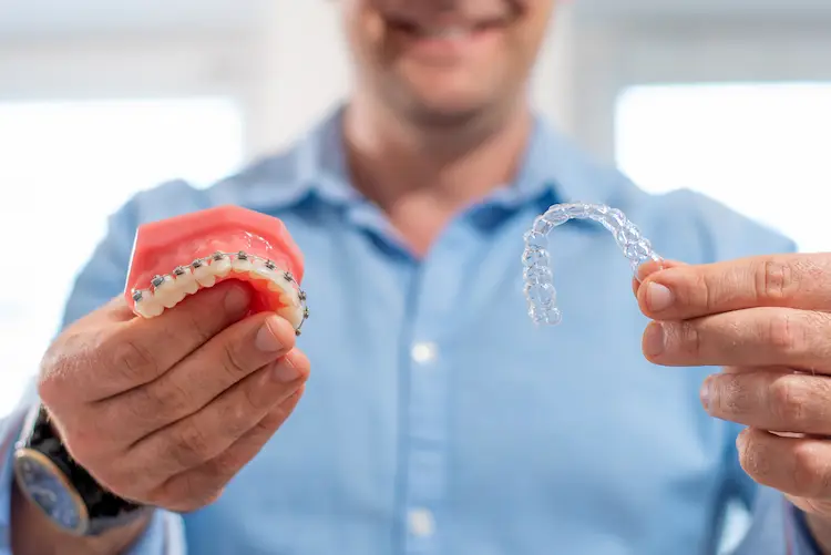 clear aligners vs traditional braces