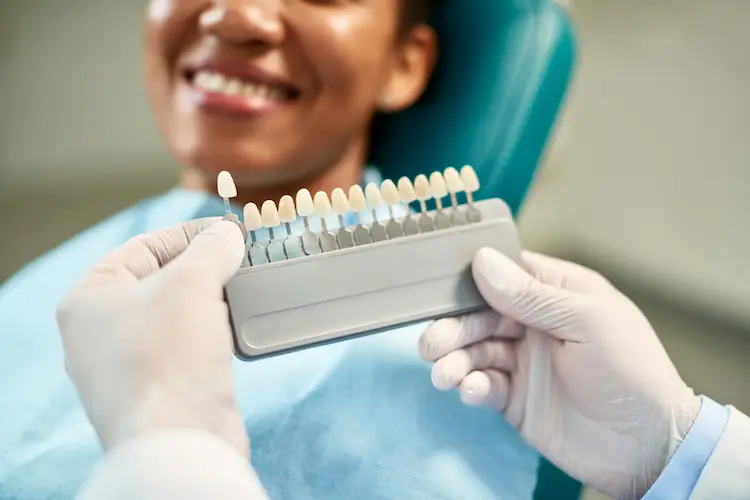 veneers istanbul cost