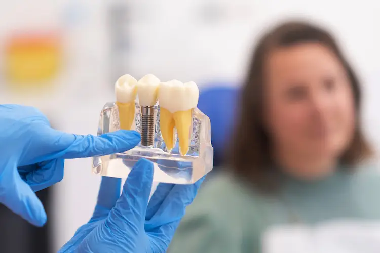 dental implants istanbul