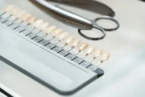 how long do veneers last