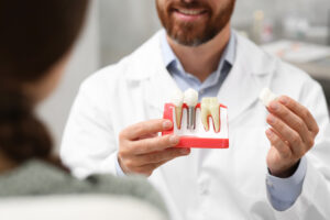 all on 4 vs all on 6 dental implants