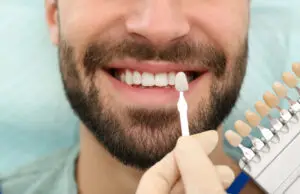 dental veneers in turkey