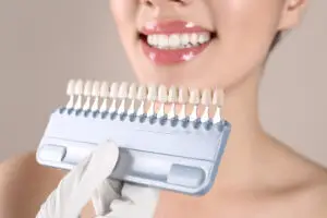 dental veneers in turkey