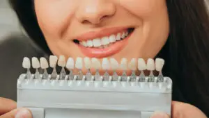 dental veneers in turkey