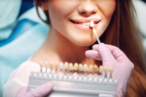 how long do veneers last