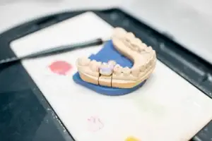 zirconia crowns turkey