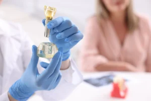 all on 6 dental implants