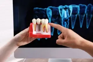 all on 4 dental implants